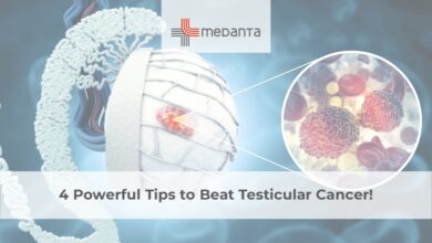 Testicular Cancer