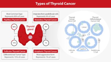Thyroid Cancer