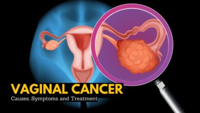 Vaginal Cancer