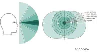 Visual Field Test