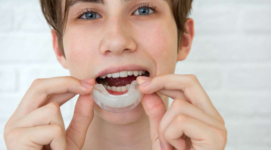We studied the bacteria on kids’ sports mouthguards. The results were eye‑opening