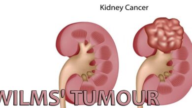 Wilms Tumor