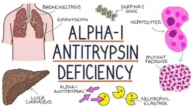 Alpha-1 Antitrypsin Deficiency