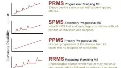 Relapsing-Remitting MS vs Progressive MS