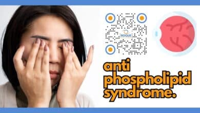 Antiphospholipid Syndrome