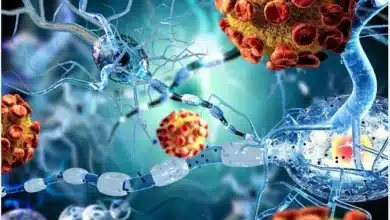 Autoimmune Encephalitis