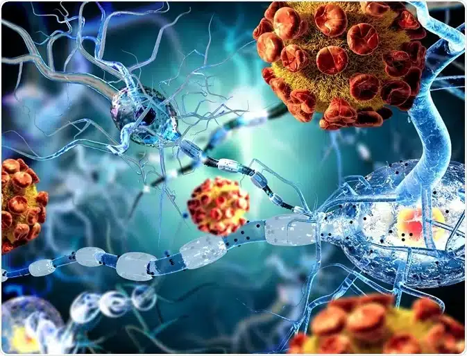 Autoimmune Encephalitis: When the Brain Becomes the Target of an Immune ...