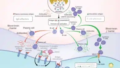 Autoimmune Encephalitis