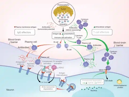 Autoimmune Encephalitis