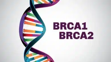 BRCA1 and BRCA2 Mutations