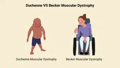 Becker Muscular Dystrophy