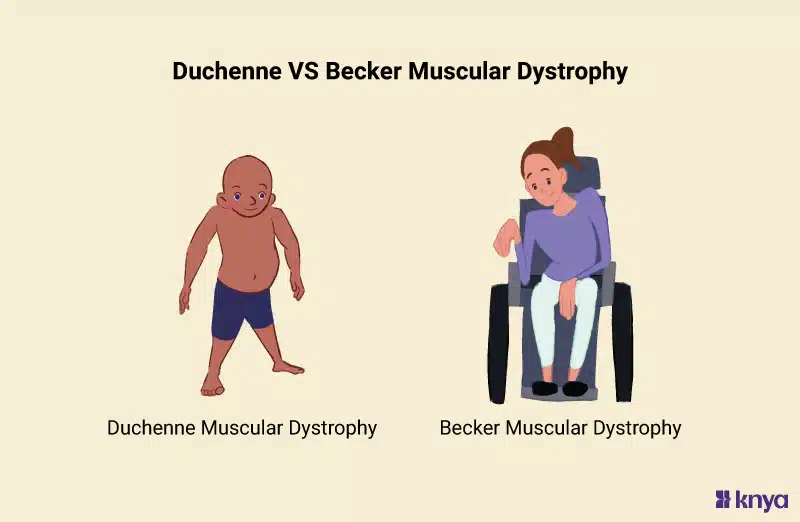 Becker Muscular Dystrophy