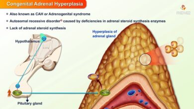 Congenital Adrenal Hyperplasia