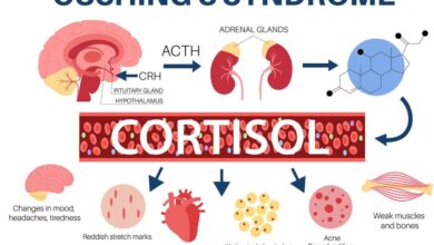 Cushing's Disease vs Cushing's Syndrome