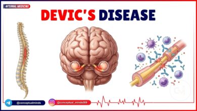 Devic's Disease (NMOSD)