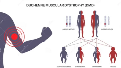 Duchenne Muscular Dystrophy