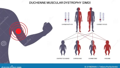 Duchenne Muscular Dystrophy