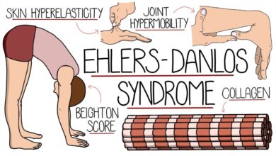 Ehlers-Danlos Syndrome