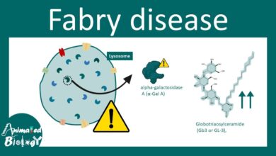 Fabry Disease