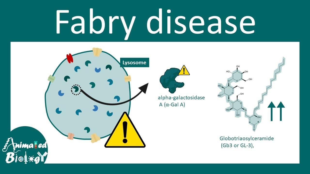 Fabry Disease