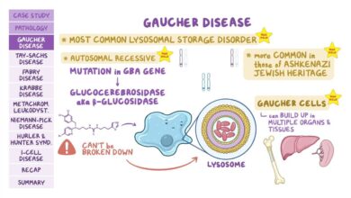 Gaucher Disease