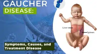 Gaucher Disease