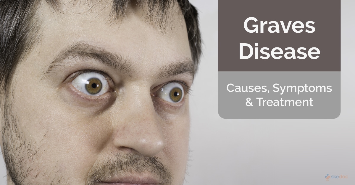 Graves' Disease