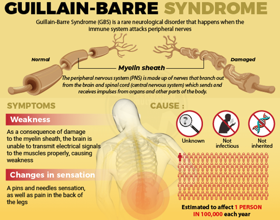 Guillain-Barré Syndrome