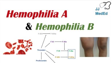 Haemophilia A vs B