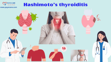 Hashimoto's Thyroiditis