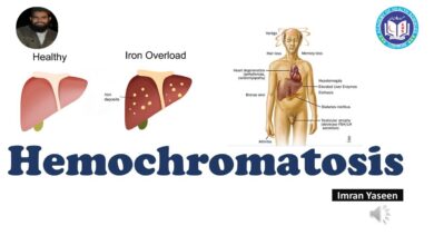 Hemochromatosis