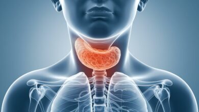 Hyperparathyroidism