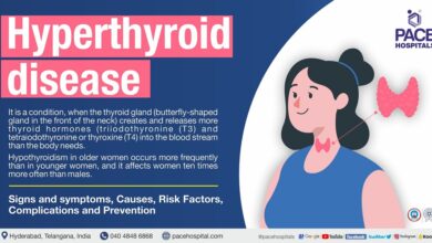Hyperthyroidism