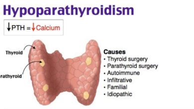 Hypoparathyroidism: The Calcium Deficiency Caused by a Hormonal Problem