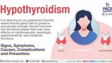Hypothyroidism