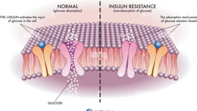 Insulin Resistance