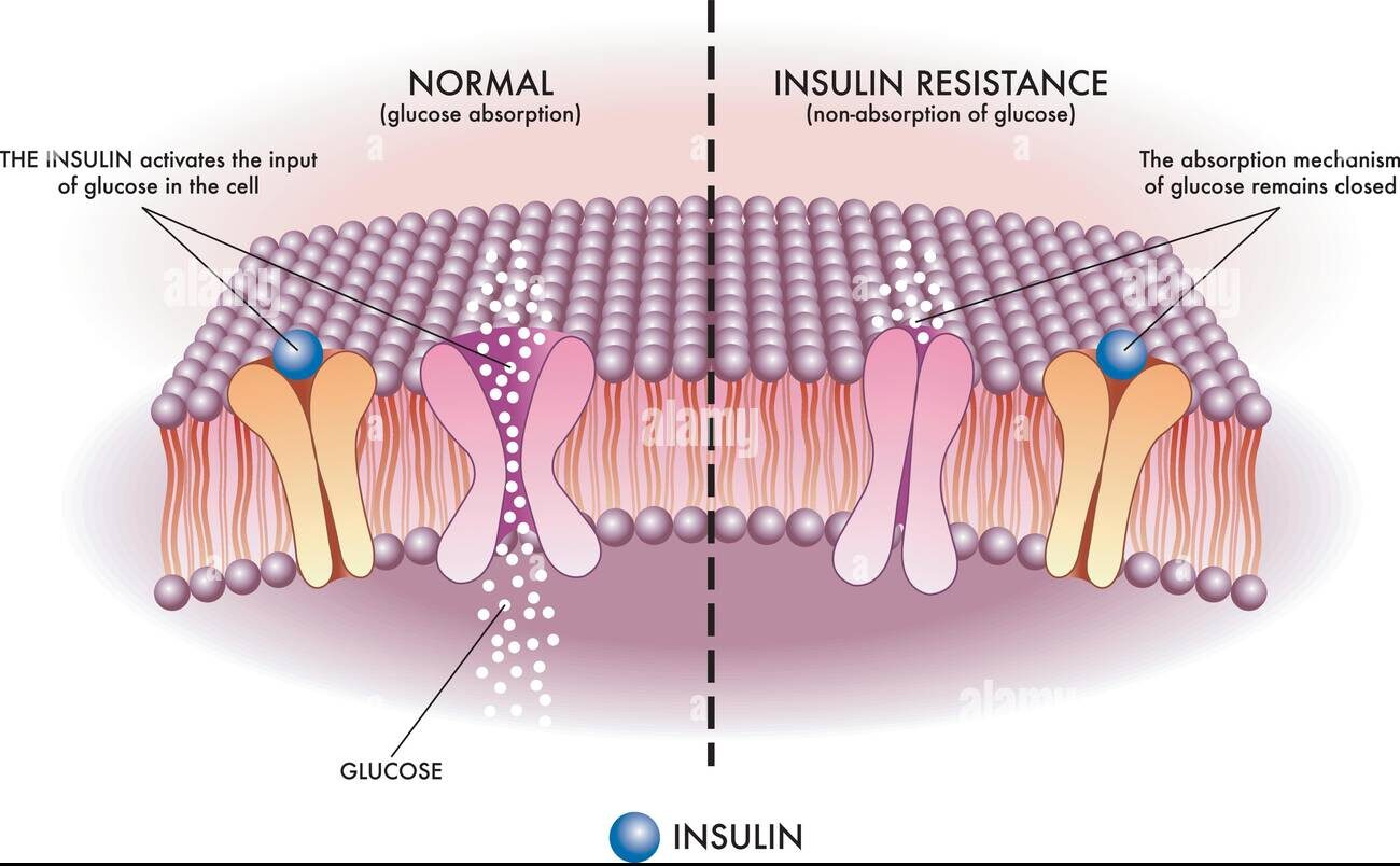 Insulin Resistance