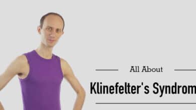 Klinefelter Syndrome (XXY)
