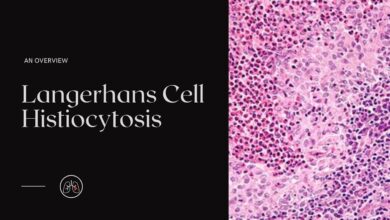 Langerhans Cell Histiocytosis