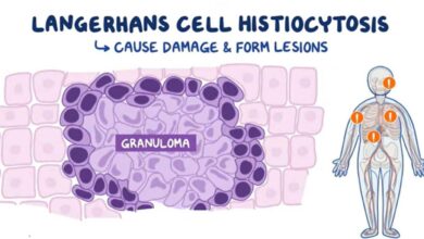Langerhans Cell Histiocytosis