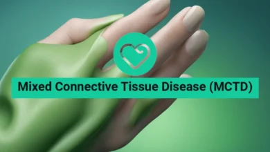 Mixed Connective Tissue Disease