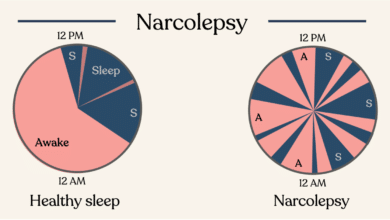 Narcolepsy