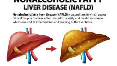 Non-Alcoholic Fatty Liver Disease (NAFLD)