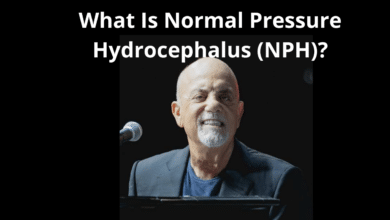 Normal Pressure Hydrocephalus