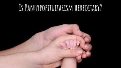 Panhypopituitarism
