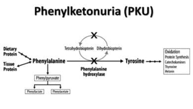 Phenylketonuria (PKU)