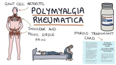 Polymyalgia Rheumatica