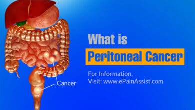 Primary Peritoneal Cancer