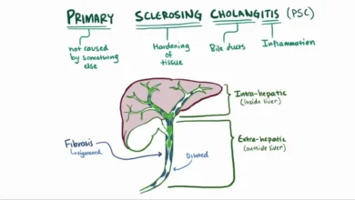 Primary Sclerosing Cholangitis (PSC)
