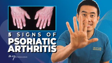 Psoriatic Arthritis